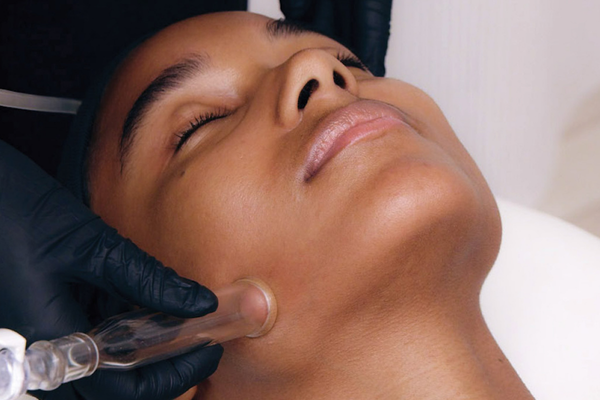 The HydraFacial: High-Performance Skincare at The Spa at The Alfond Inn Image