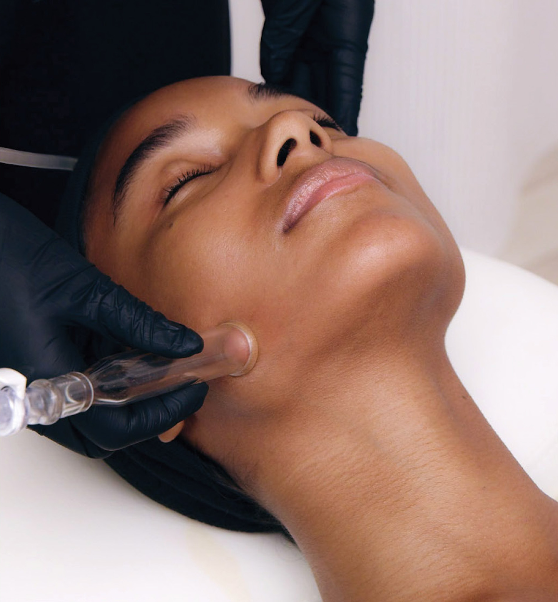 Facial Treatment