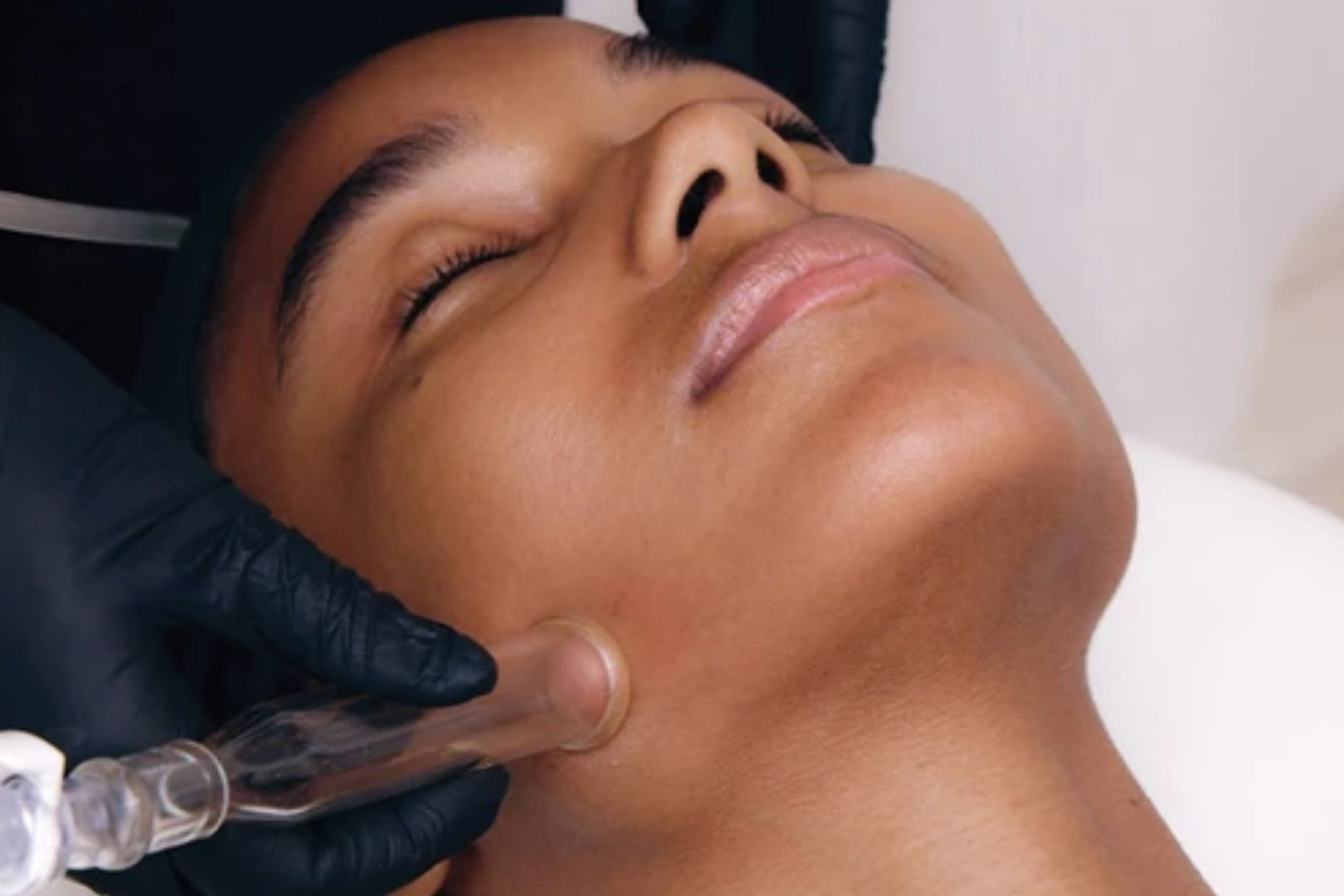 Image of HydraFacial MD Deluxe