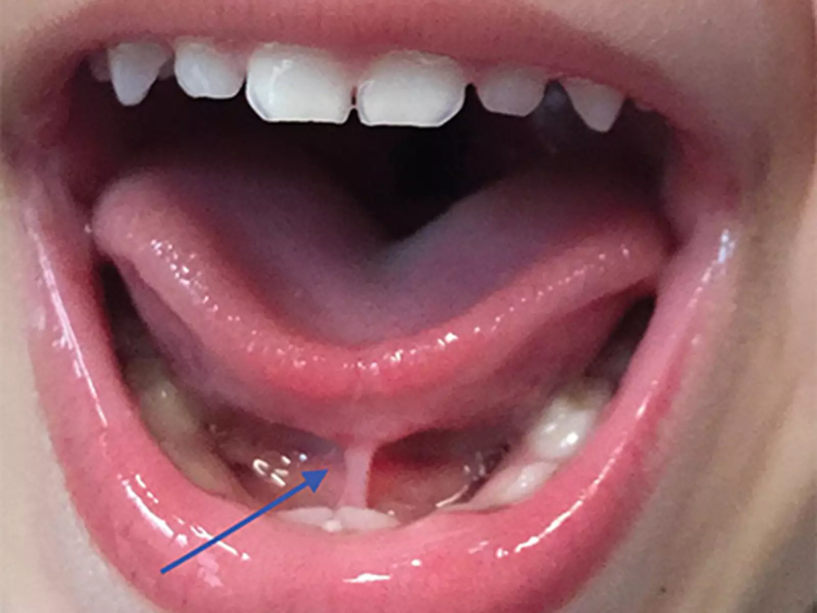 Services Plaistow Pediatric Dentistry Orthodontics services-plaistow-pediatric-dentistry-orthodontics